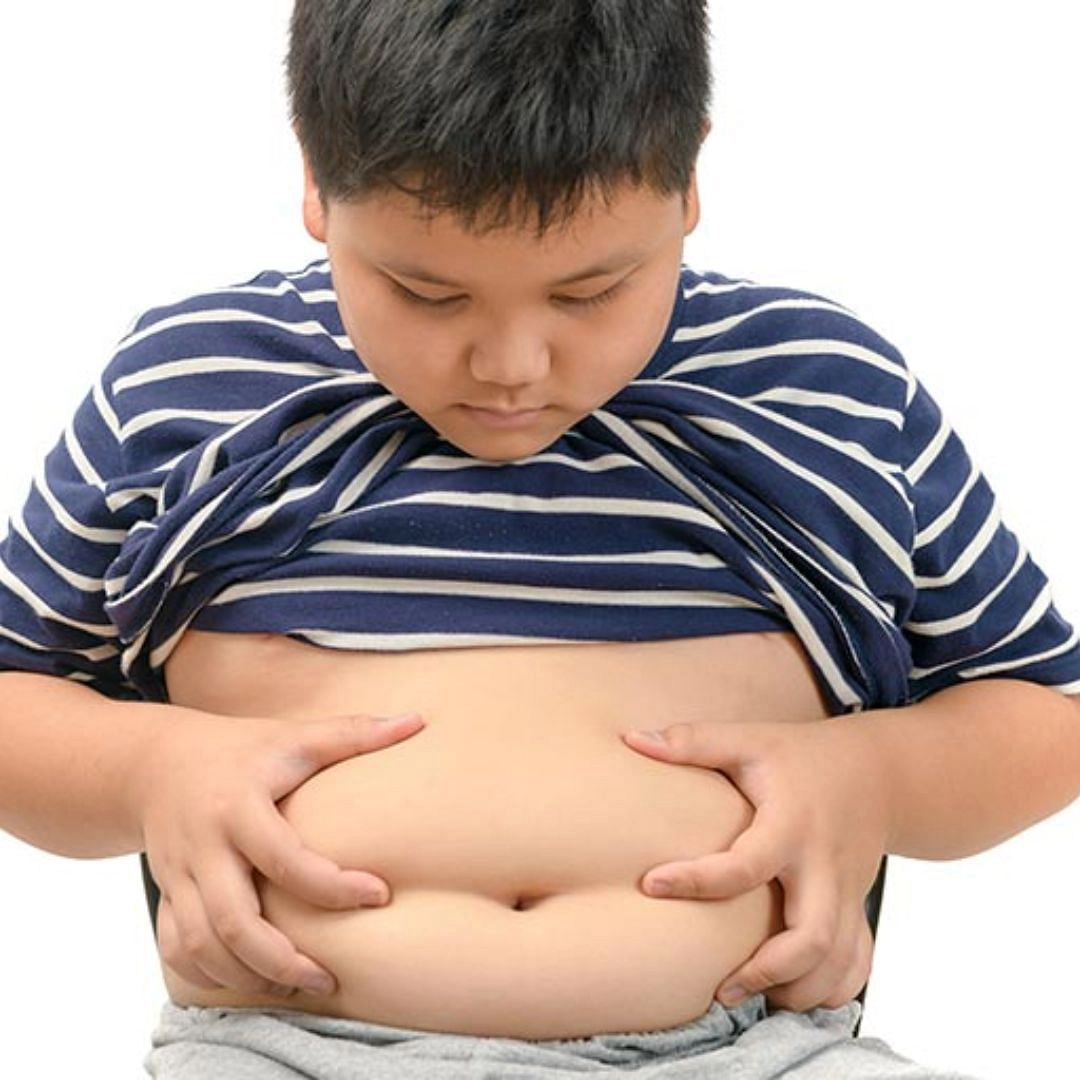 Child Obesity