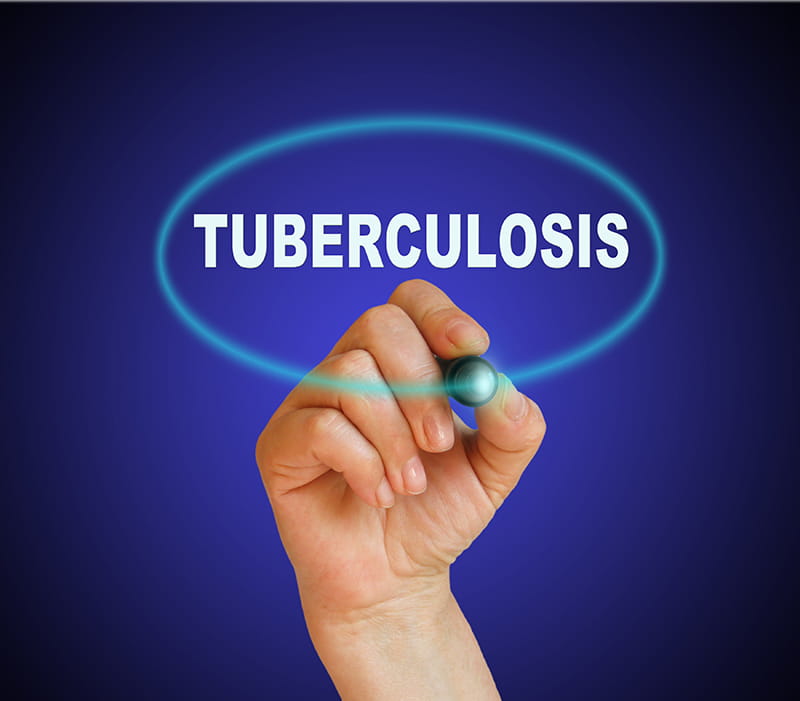 Tuberculosis_3
