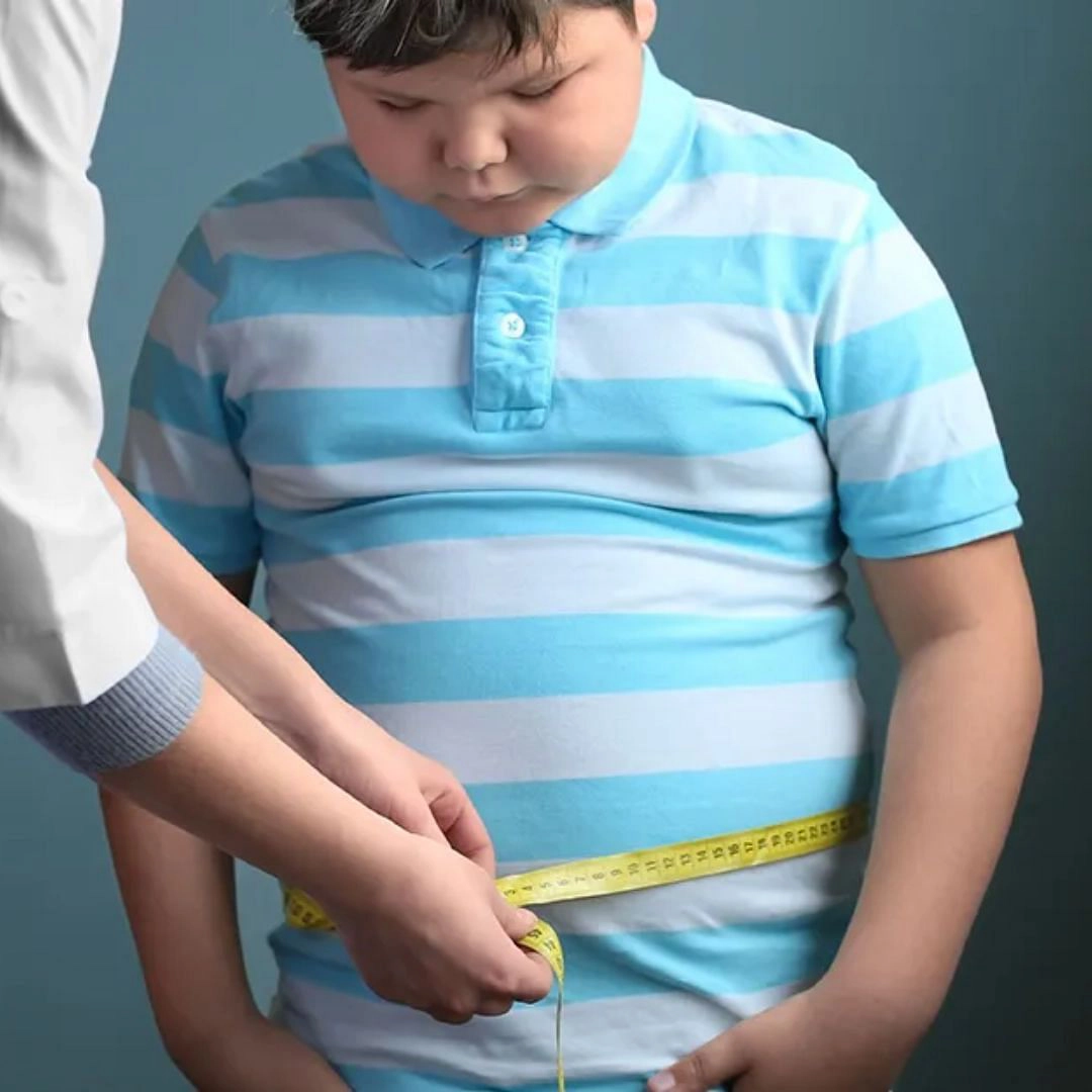 MChildObesity3