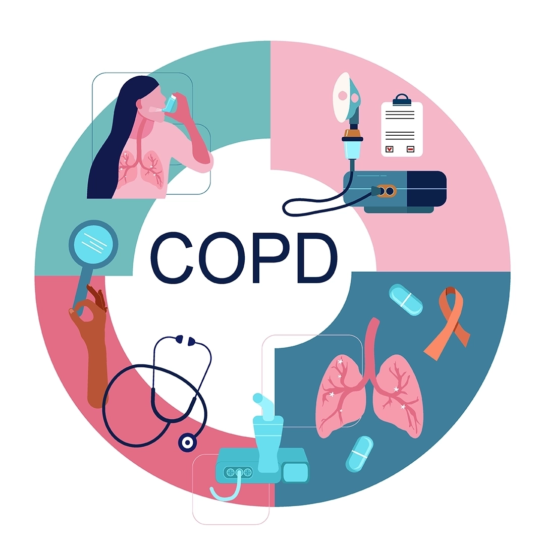 COPD_JS