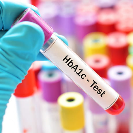 NHbA1c1