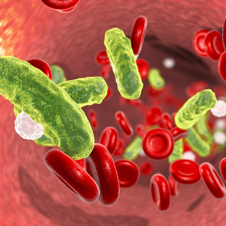 NNSepsis1