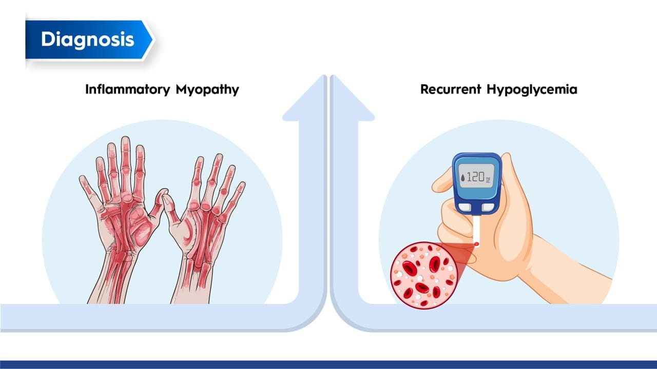 image NP